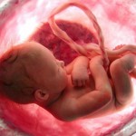 Can Atheists Defend Abortion Without Defending Infanticide?