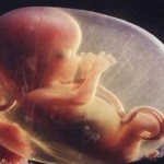 Abortion, Souls, and the Atheist Conundrum